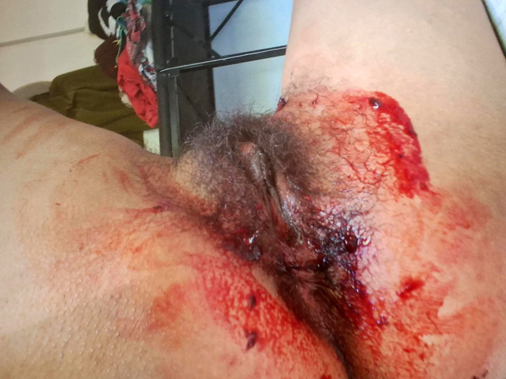 2025-11-24 Использованные прокладки и менструация [Menstruation, Tampons, Pads, Period, Blood] [1000*750 до 4752*3168, 4200 фото]