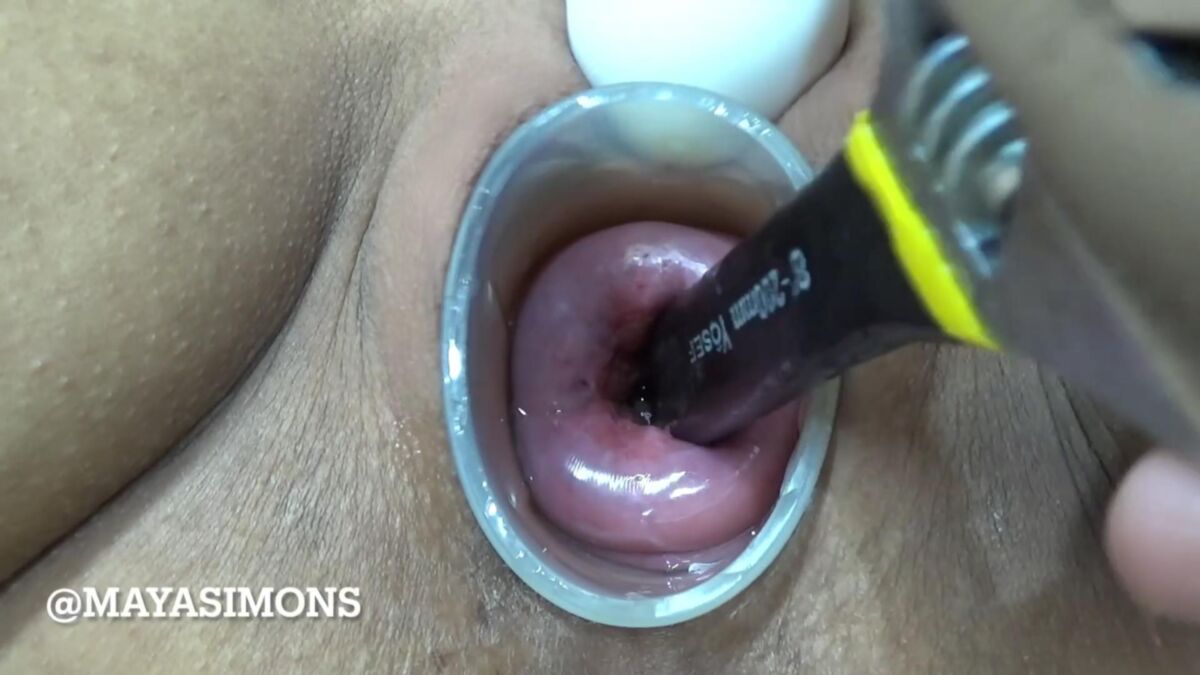 [Onlyfans.com] Maya Simons/Brunette 2 Wrenches in Cervix [2022, Cervix, Insert, Gape, 1080p] | Free Porn Torrent